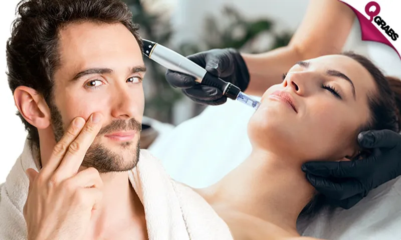 Full Face Dermapen Session!